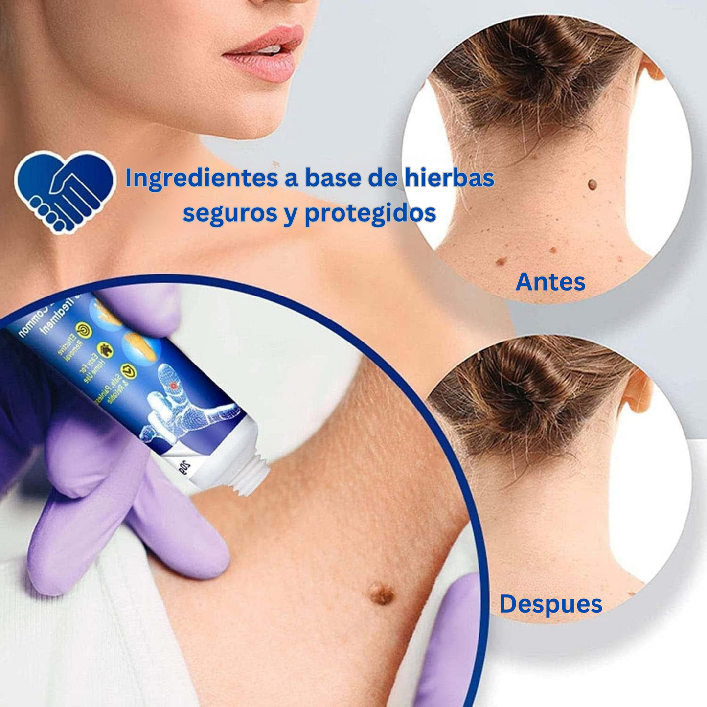 Crema Eliminadora de Verrugas: Solución Rápida y Efectiva