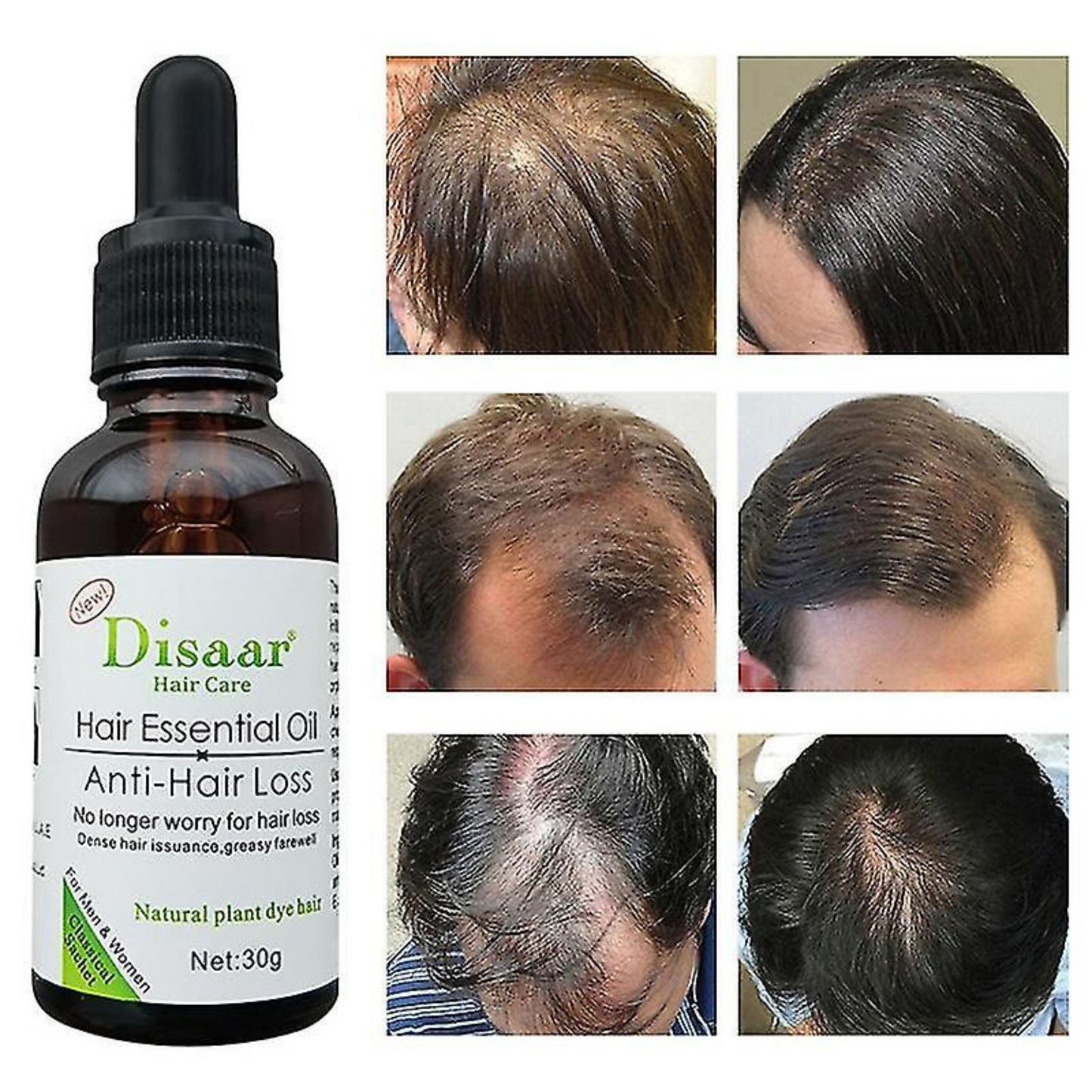 Suero Anti-Caída del Cabello