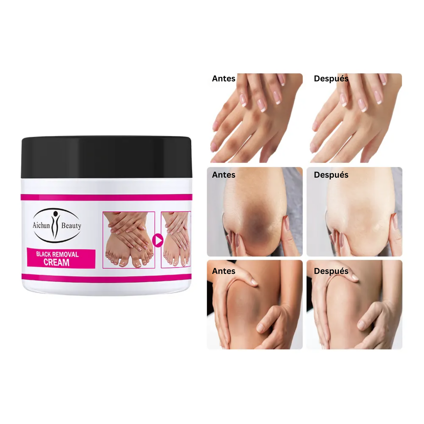 Crema Aclaradora para Manchas Oscuras