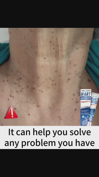 Crema Eliminadora de Verrugas: Solución Rápida y Efectiva